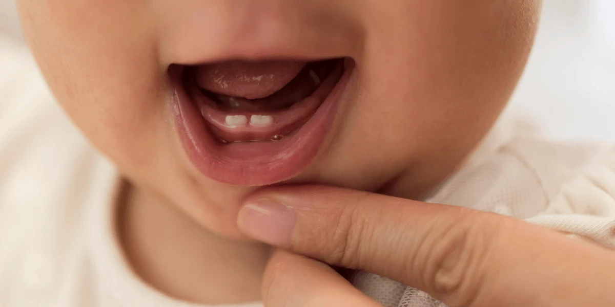 Can a Baby Be Born With Teeth